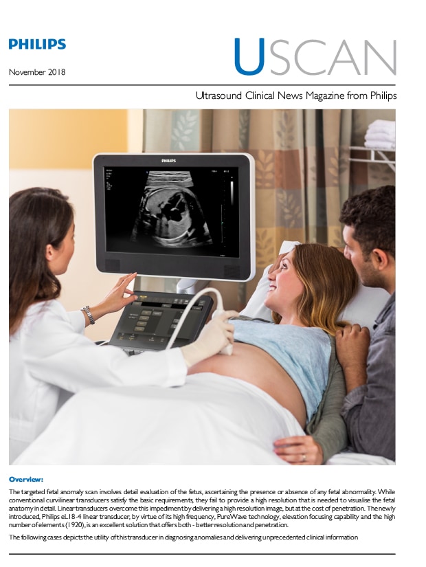 USCAN: Ultrasound Clinical News Magazine from Philips