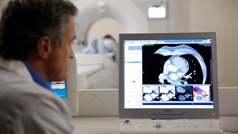 Cardiólogo que adquiere imágenes con Spectral CT para el diagnóstico de la coronariopatía