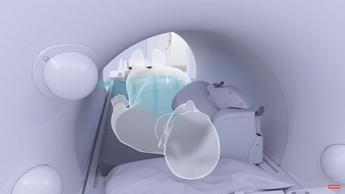 Vídeo publicado en YouTube del MR SmartWorkflow de Philips en acción