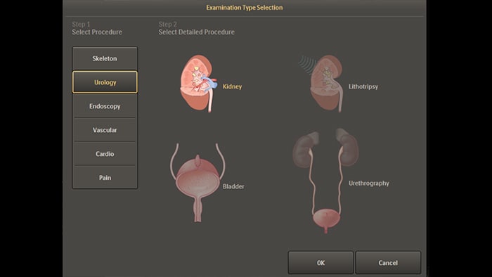 Configuración anatómica predeterminada para los procedimientos de urología y endoscopia