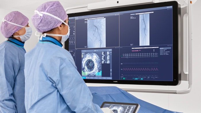 Intervenciones en arteriopatía periférica