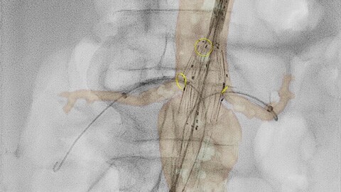 Flujo de trabajo de radiología flexible