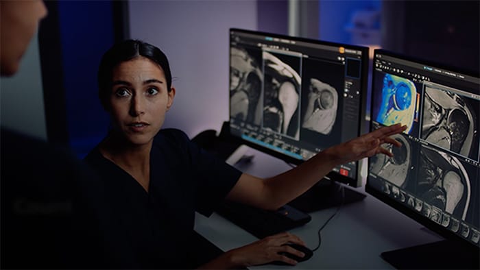 Vídeo de la técnica de RM con pantallas en la sala de control, que muestra cómo se pueden preparar las exploraciones antes de que lleguen los pacientes