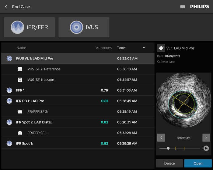 IntraSight Single Case Menu