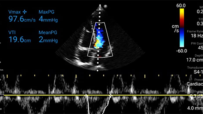 Cardiac chart thumbnail