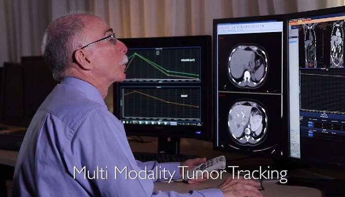 Evaluación del tratamiento mediante la cuantificación: seguimiento de tumores en modalidades múltiples en el Portal IntelliSpace