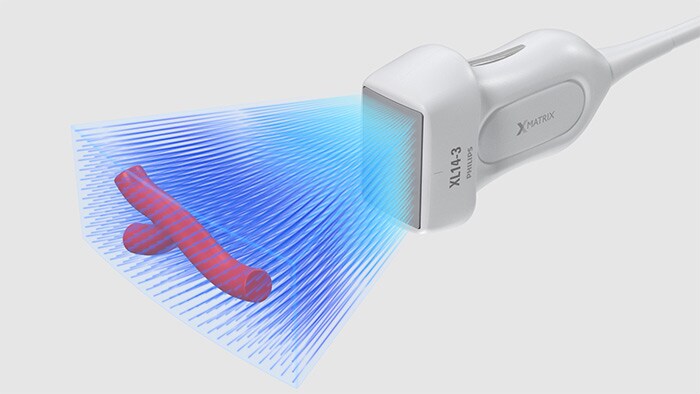 Resolución 3D/4D de alta calidad