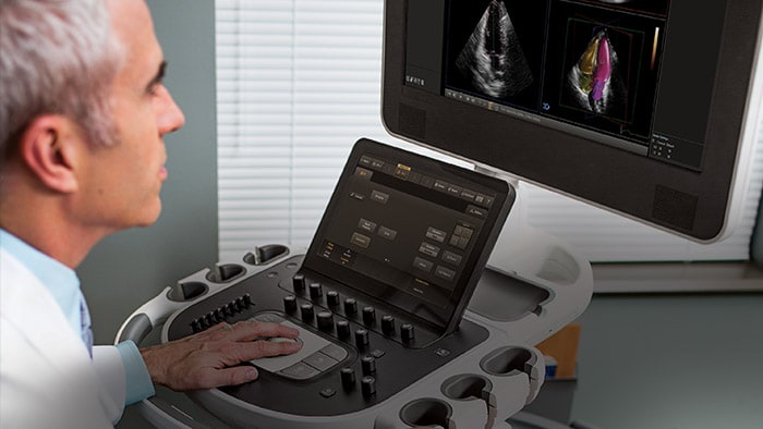 Philips realiza el Congreso Virtual de Ecocardiografía e Imagen Cardíaca