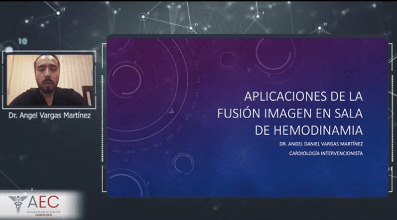Webinar Aplicaciones de la fusión de imagen en la sala de hemodinamia – Dr. Angel D. Vargas Martínez