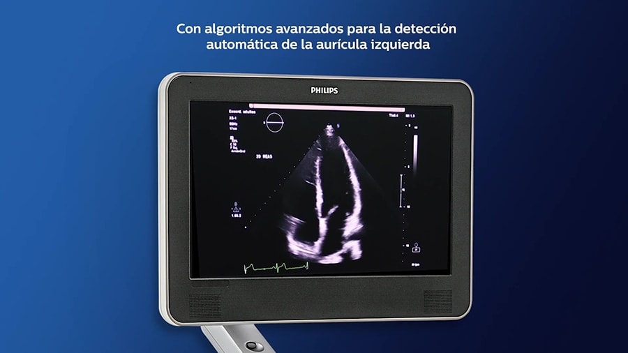 AutoStrain aurícula izquierda