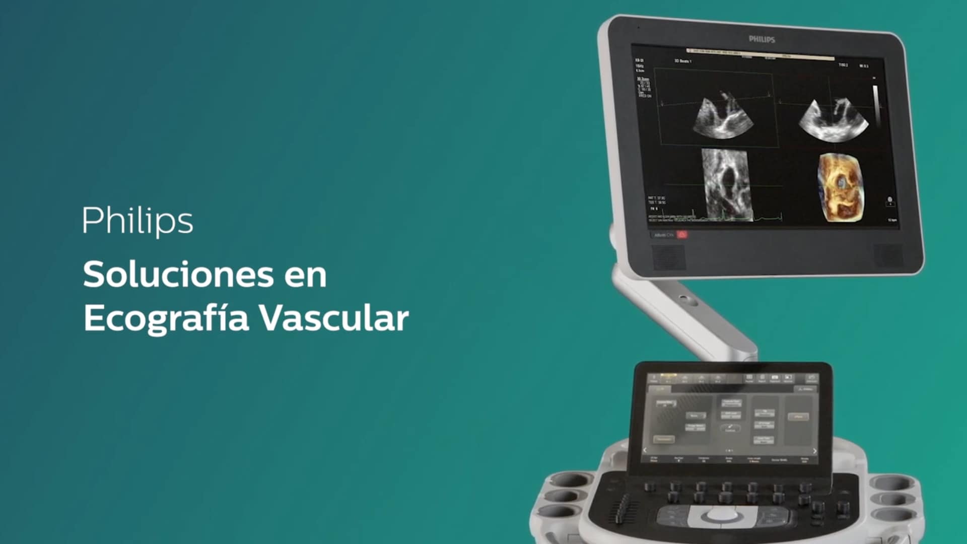 Philips Ecografía Vascular