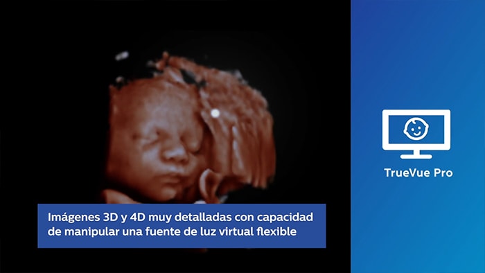 Solución Materno Fetal