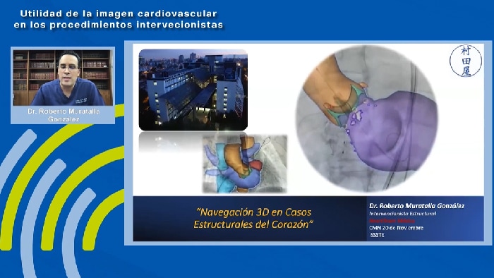 Navegación 3D en casos estructurales del corazón - Dr. Roberto Muratalla González