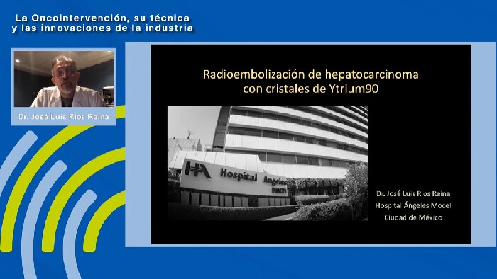 Radioembolización de hepatocarcinoma con cristales de Ytrium 90 – Dr. José Luis Rios Reina