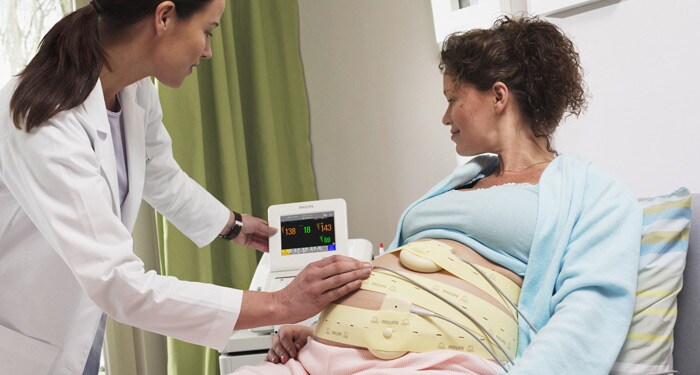 Sistemas de monitoreo materno y fetal