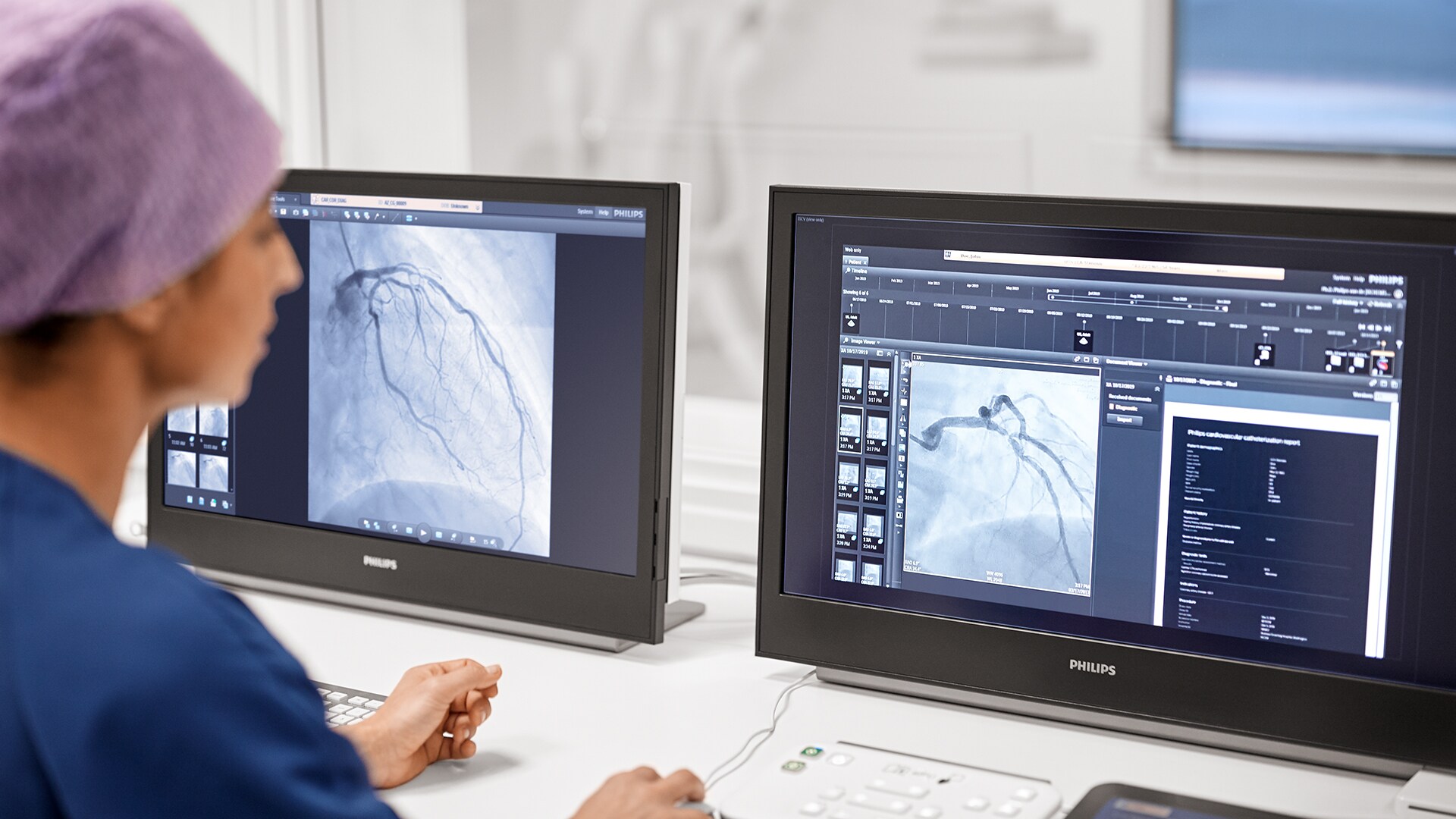 Cómo la innovación hemodinámica avanzada ayuda a transformar el tratamiento de enfermedades cardiovasculares