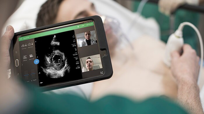 La FDA autoriza el uso de los ultrasonidos de Philips en pacientes con complicaciones pulmonares y cardiacas relacionadas con COVID-19