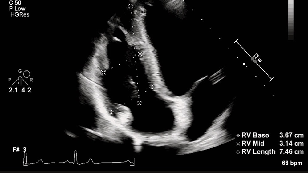 3 Ultrasound measurements