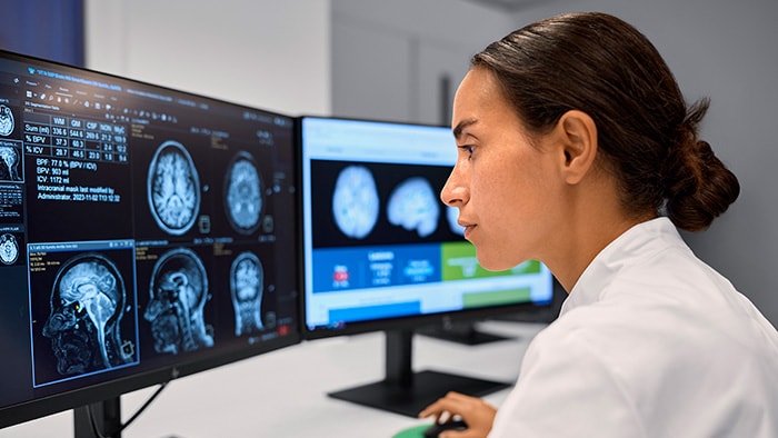 MR technologist reviewing neuro images in AI reporting